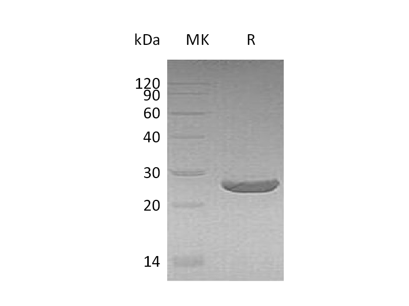 Recombinant Human PRDX1 (N, C-6His)
