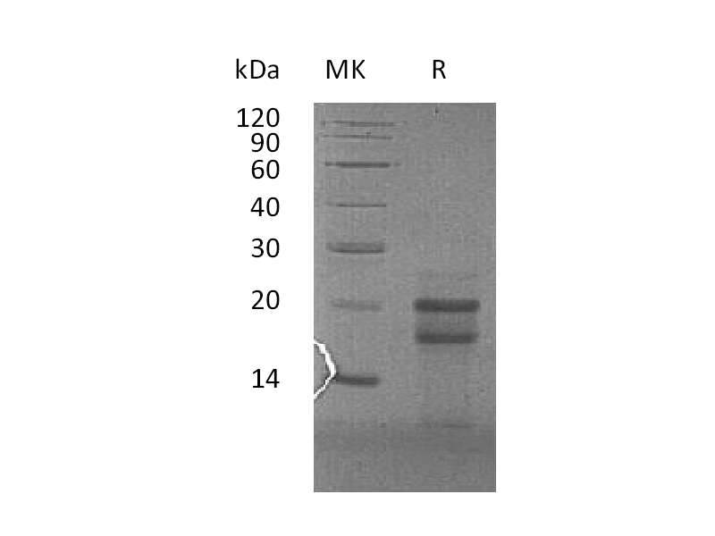 Recombinant Human PFDN4 (N-6His)