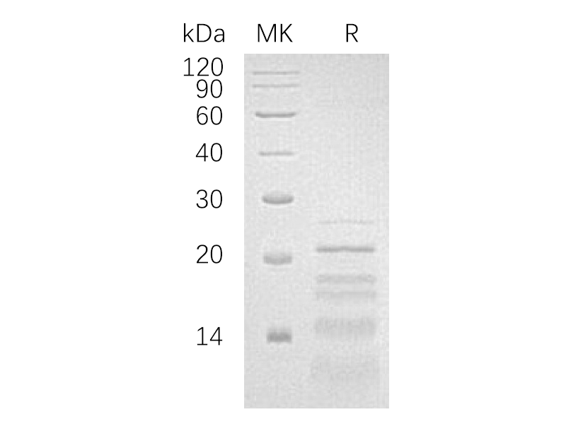 Recombinant Human PHLDA2 (C-6His)