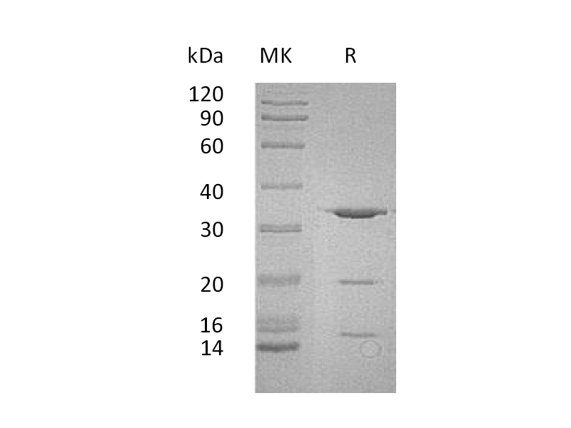 Recombinant Human PITPNA (N-6His)