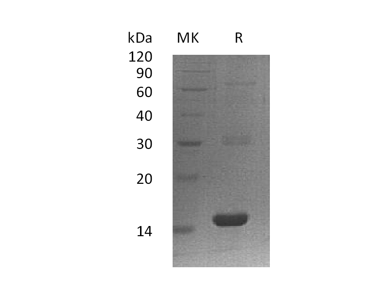 Recombinant Human PLA2G16 (N-6His)