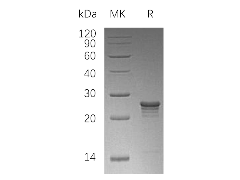 Recombinant Human PMVK (N-6His)