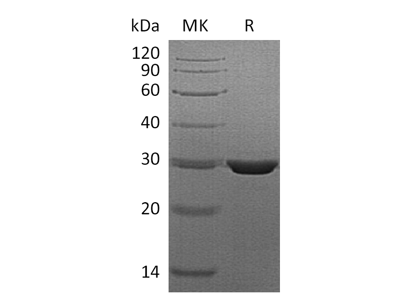 Recombinant Human PMM2 (C-6His)