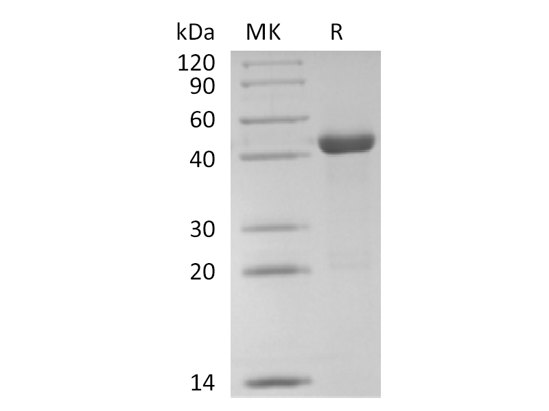 Recombinant Human PPM1A (C-6His)