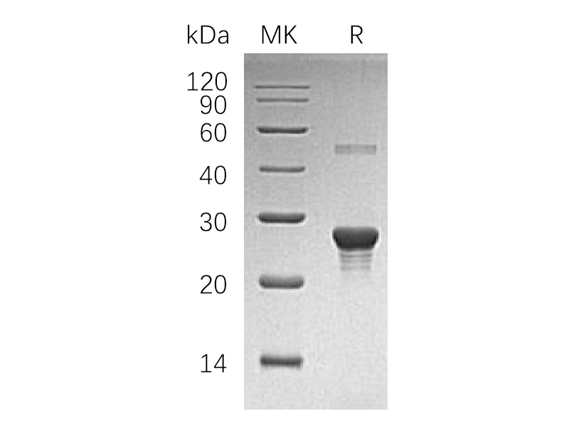 Recombinant Human PPC-DC (N-6His)