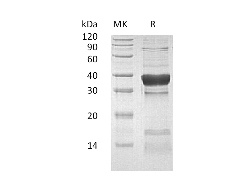 Recombinant Human PPP1CC (N, C-6His)