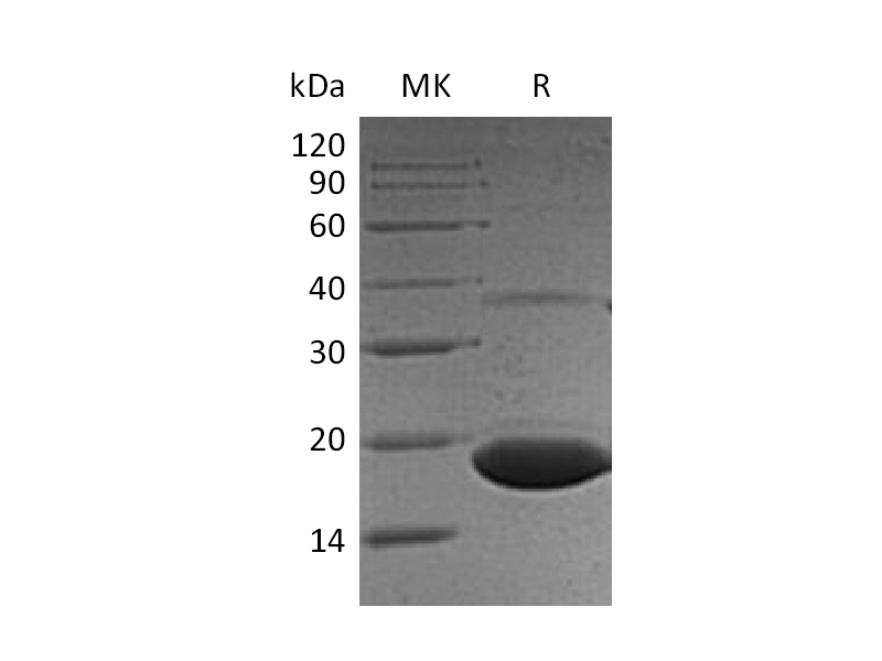 Recombinant Human PPP1R1A (C-6His)