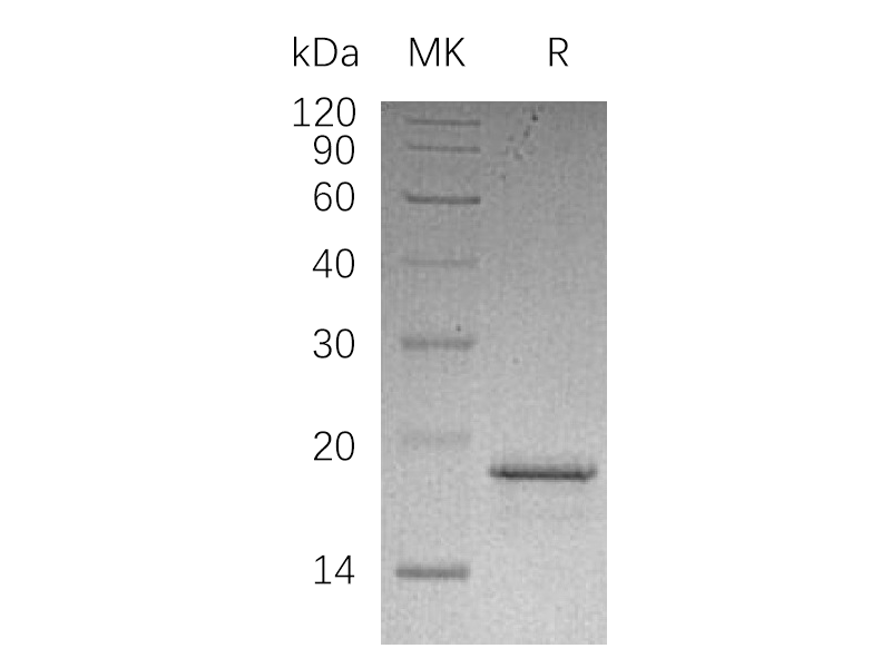 Recombinant Human PFDN2 (N-6His)