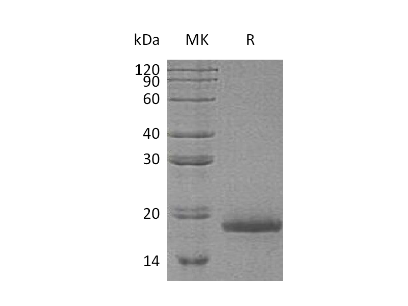 Recombinant Human TAC1 (N-6His)