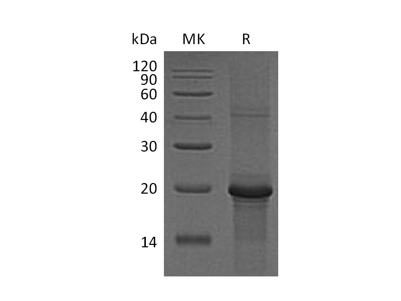 Recombinant Human PKCE (C-6His)