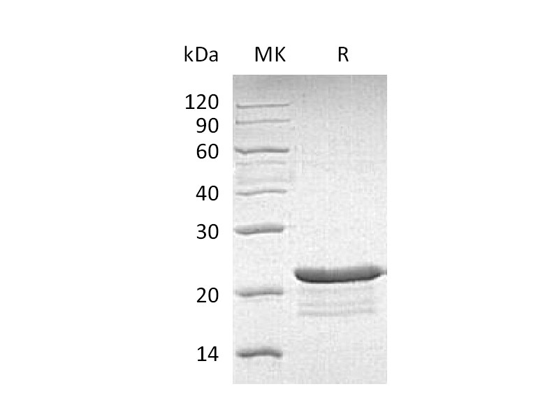 Recombinant Human PPP1R14A (C-6His)