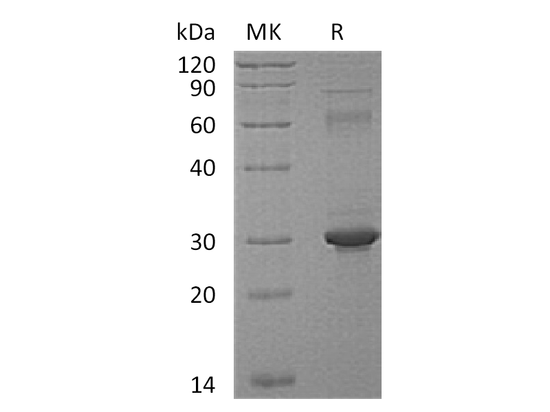 Recombinant Human PP1MG (C-6His)