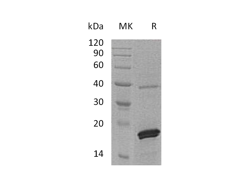 Recombinant Human PRL2 (C-6His)