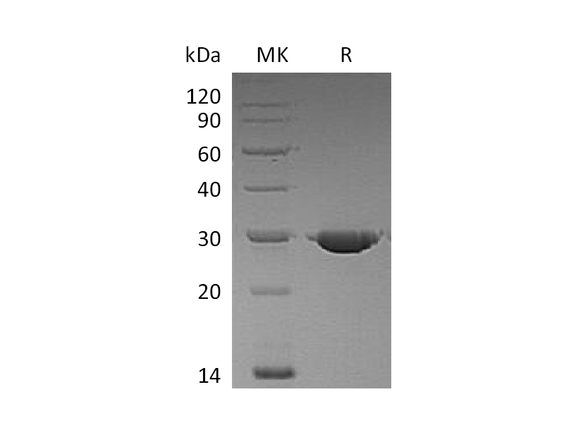Recombinant Human PSP (C-6His)