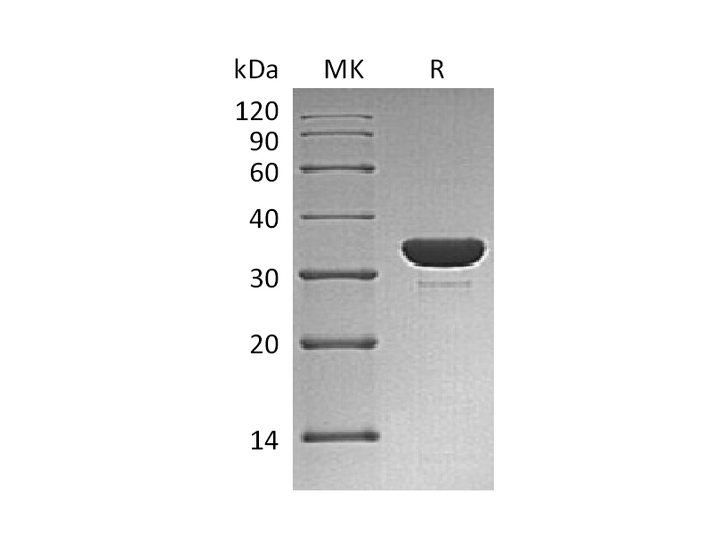 Recombinant Human PTP1C (C-6His)