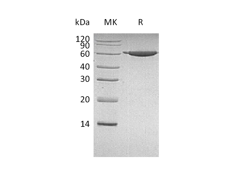 Recombinant Human PKM2 (N-6His)
