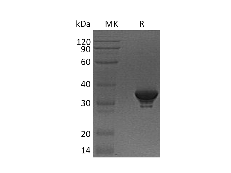 Recombinant Human QPRTase (N-6His)