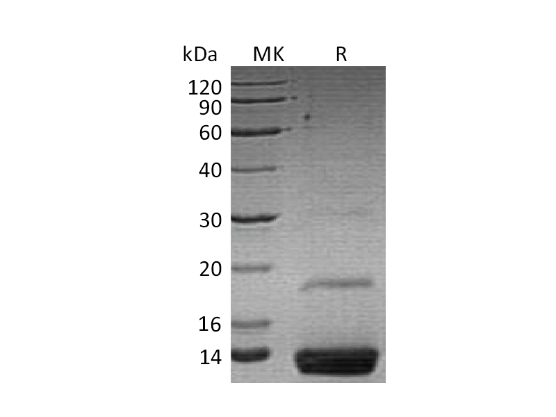Recombinant Human Resistin  (C-6His)