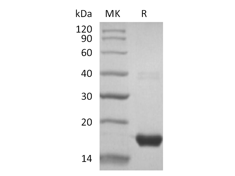 Recombinant Human GGACT (N-6His)