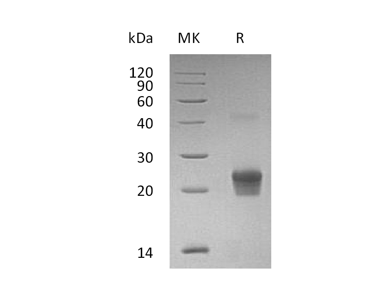 Recombinant Human GGCT (N-6His)
