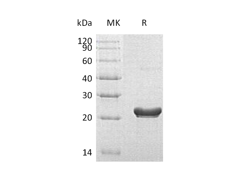 Recombinant Human RPS7 (C-6His)