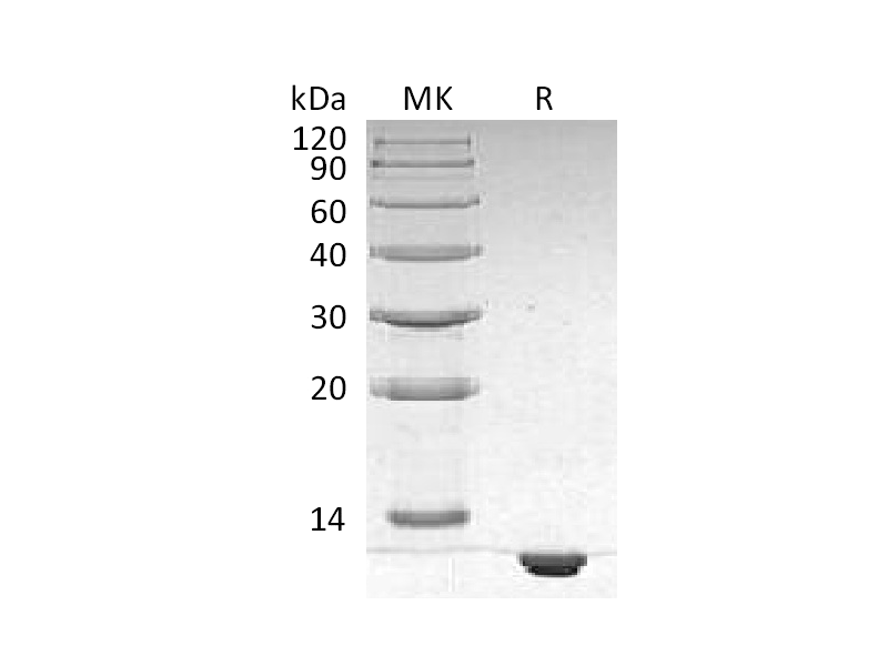Recombinant Human S100B (N-6His)