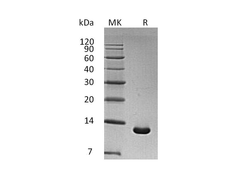 Recombinant Human S100A6 (N-6His)
