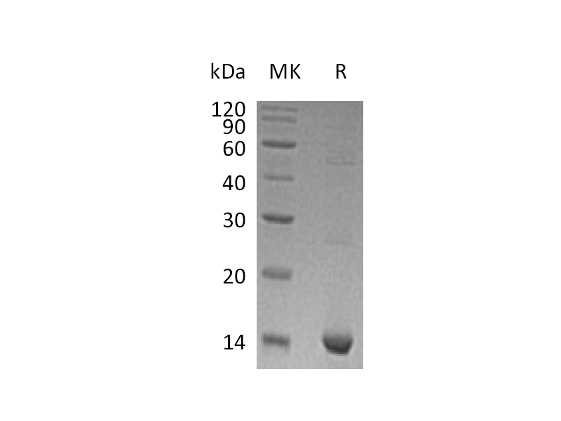 Recombinant Human S100A9