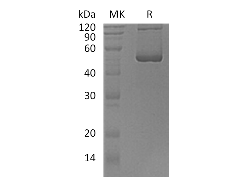 Recombinant Human SCLY (N-6His)