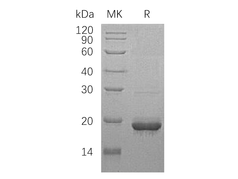 Recombinant Human SCO1 (N-GST)