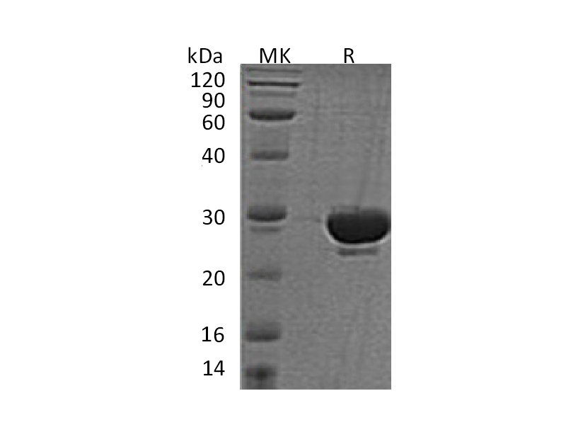 Recombinant Human SENP2
