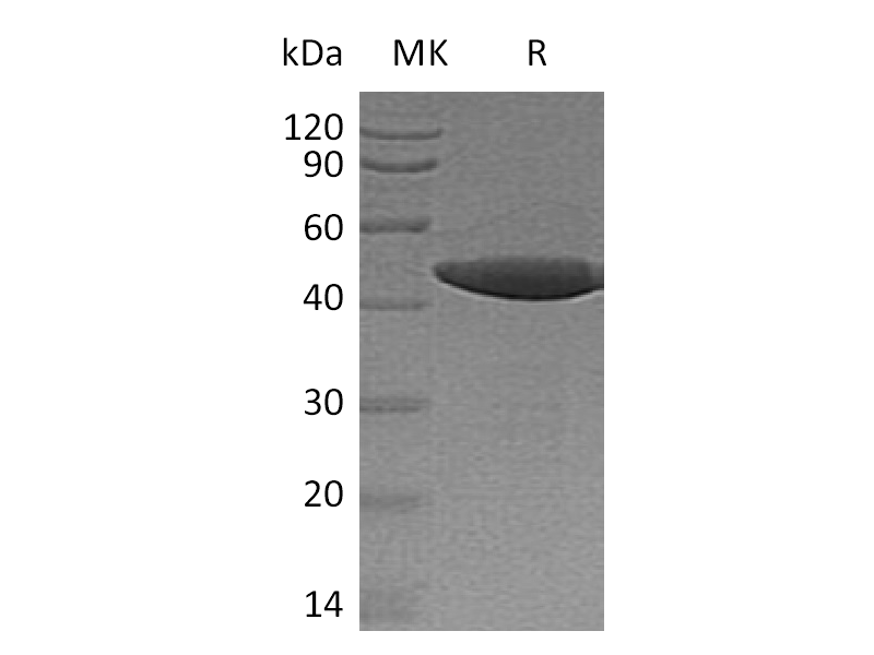 Recombinant Human SENP7