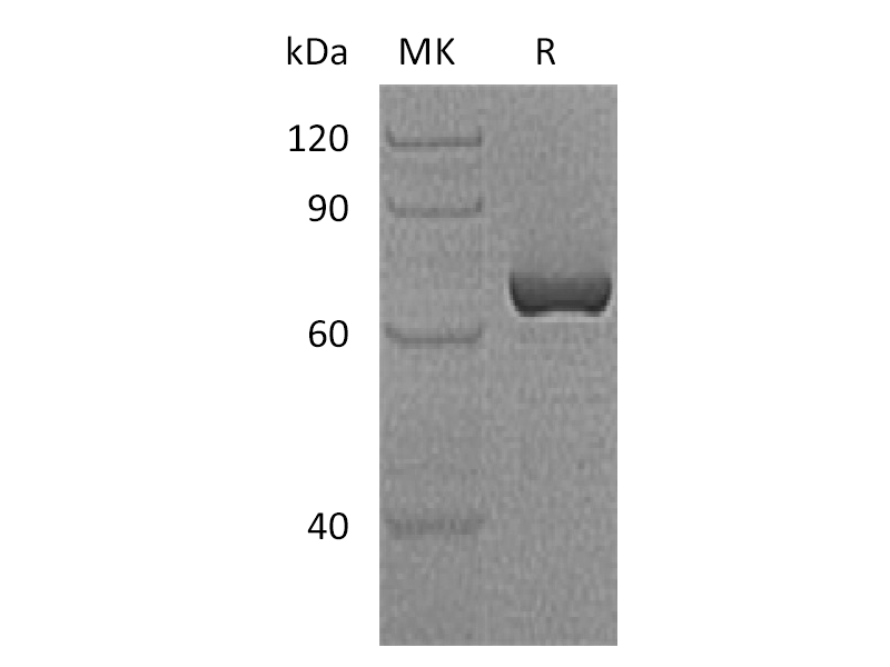 Recombinant Human Serpin A12 (N-GST)