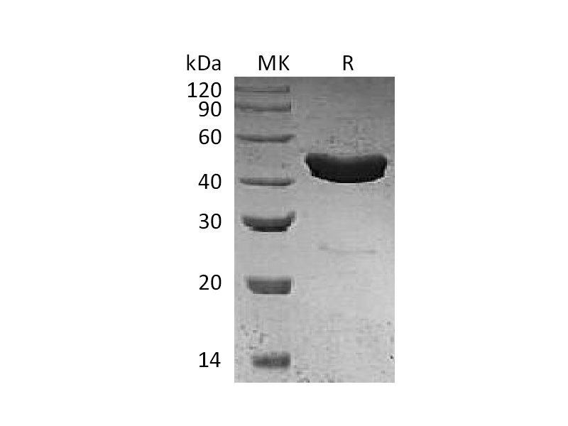 Recombinant Human Serpin B3 (N-6His)