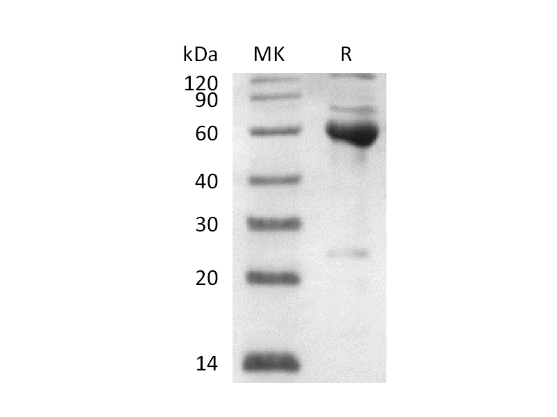 Recombinant Human Serpin B6 (N-Trx-6His)