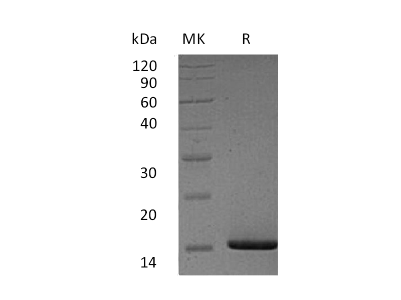 Recombinant Human SAA1 (N-6His)