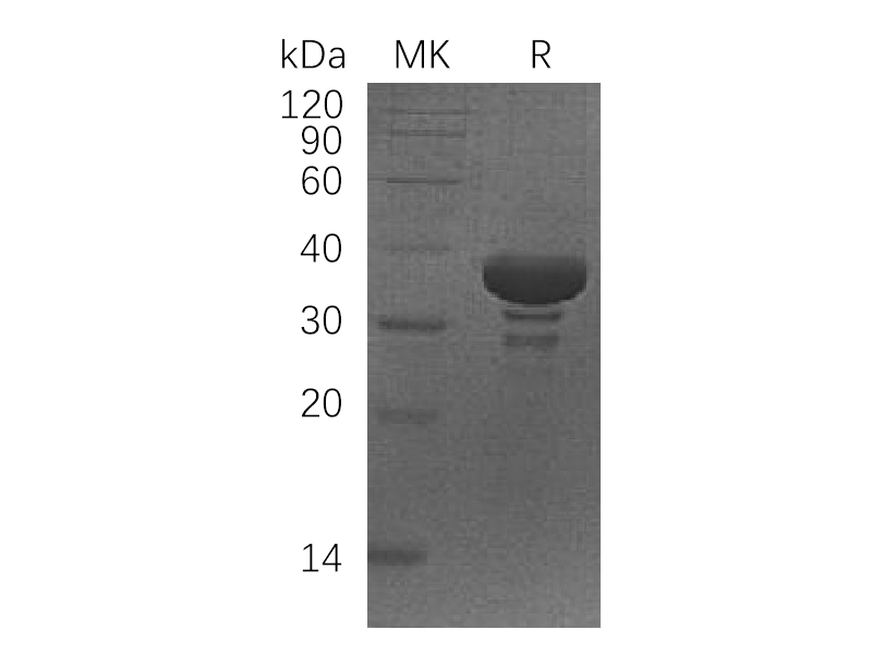Recombinant Human SGTA (N-6His)