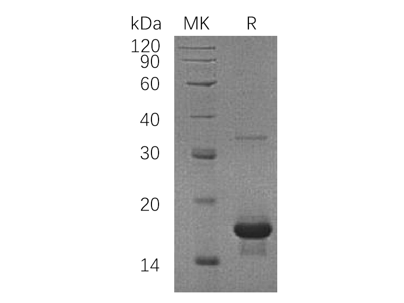 Recombinant Human SH2D1A (N-6His)