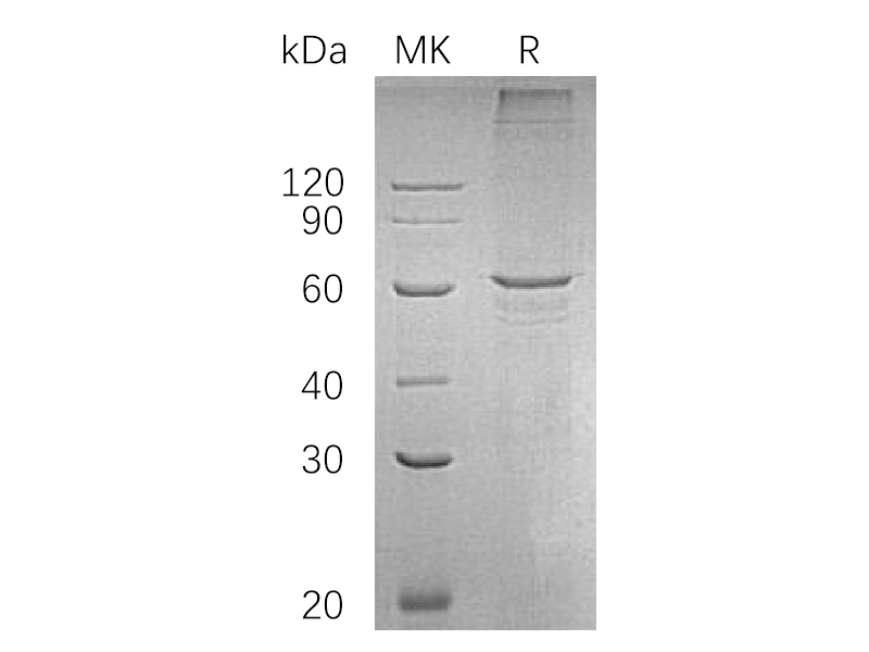 Recombinant Human SMAD4 (C-6His)