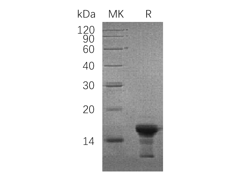 Recombinant Human SNCG