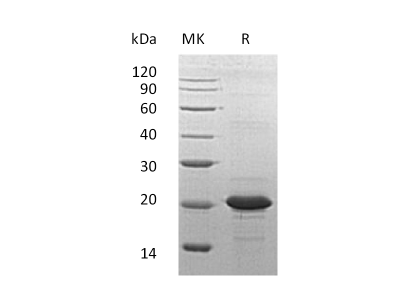 Recombinant Human SOD1 (N-6His)