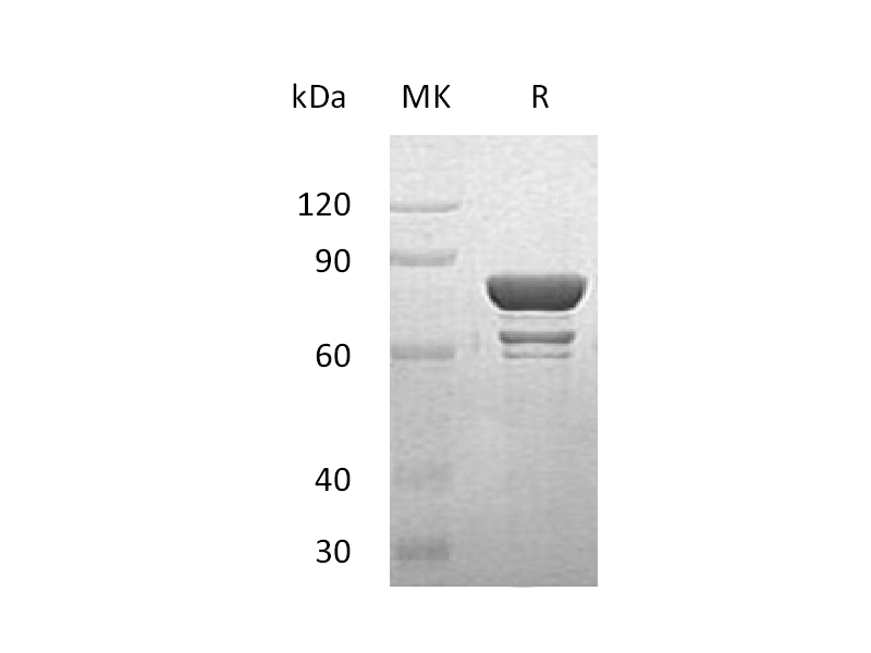Recombinant Human STAT1