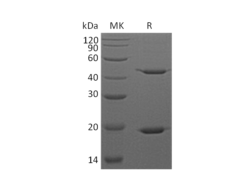 Recombinant Human STAT3 (C-6His)