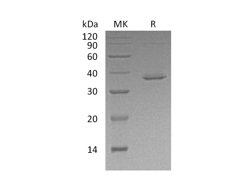 Recombinant Human STAT5B (C-6His)