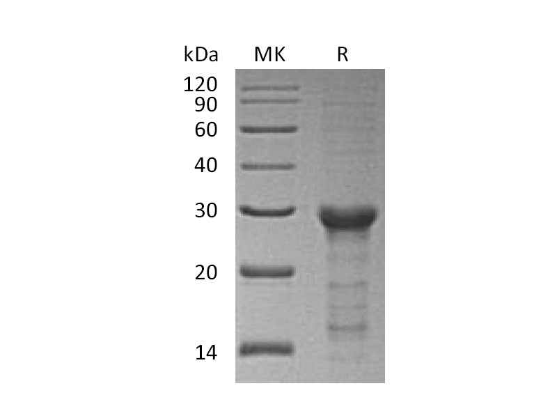 Recombinant Human STAT6 (C-6His)