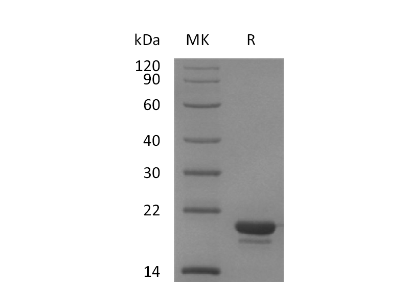 Recombinant Human Stathmin (C-6His)