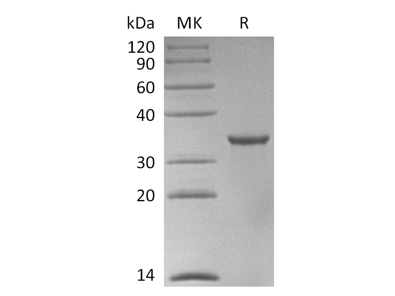 Recombinant Human STUB1