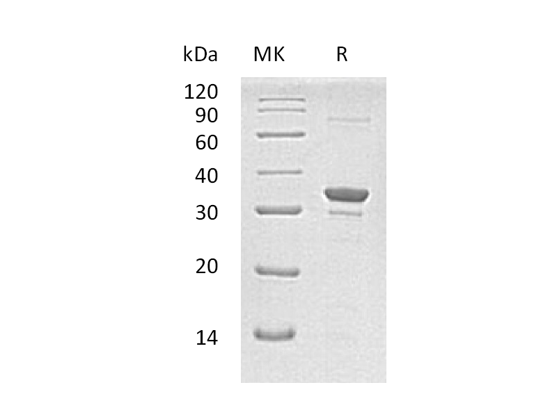 Recombinant Human SULT1A2 (N-6His)