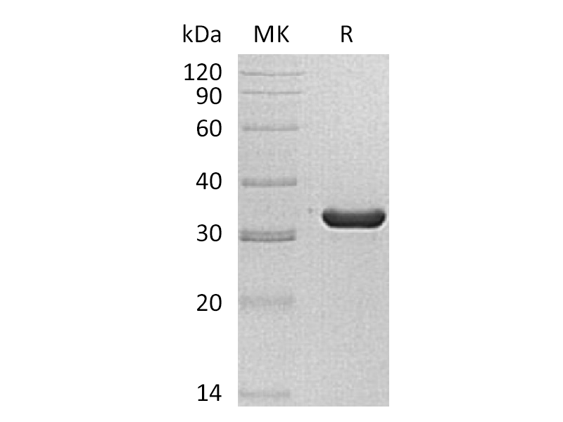 Recombinant Human SULT1C2 (N-6His)