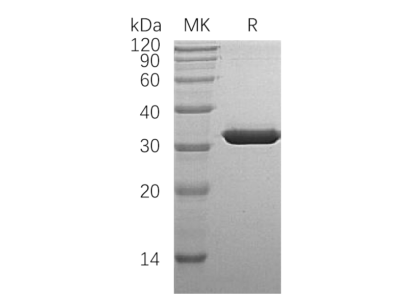 Recombinant Human SULT1A1 (N-6His)